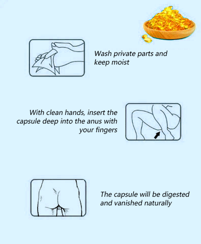 Capsules hémorroïdes à base des plantes naturelles et super efficace