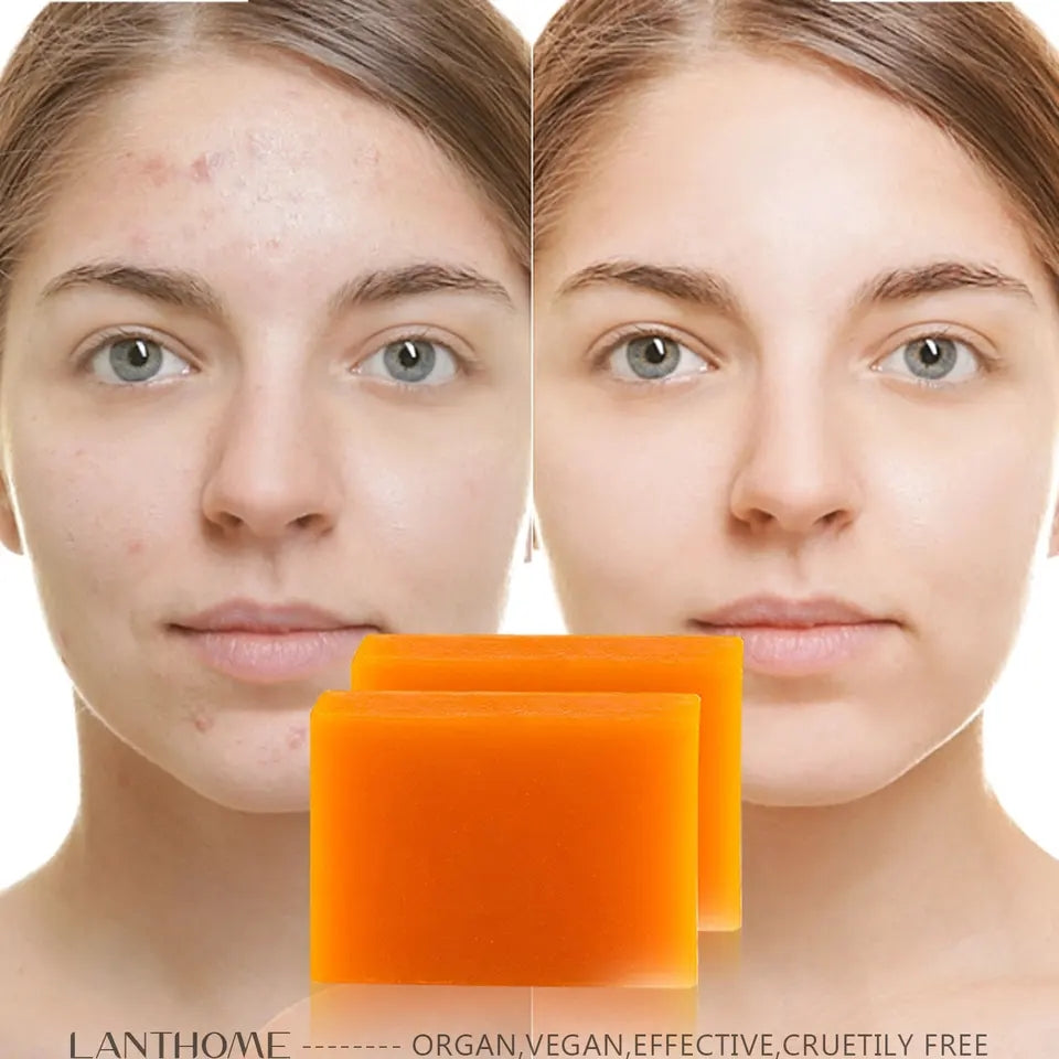 Savon KOJIE SAN Anti-dépigmentation