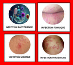 Crème anti-infection