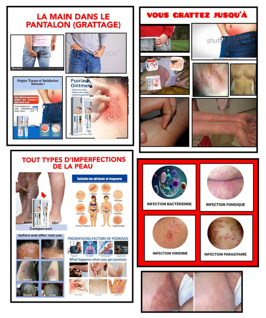 Crème anti-infection