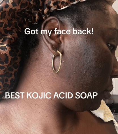 Savon KOJIE SAN Anti-dépigmentation